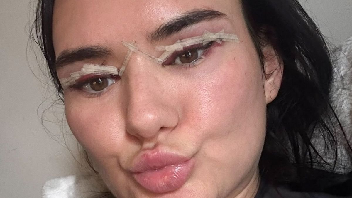 A plătit 849 de dolari pentru „pleoape de influencer”