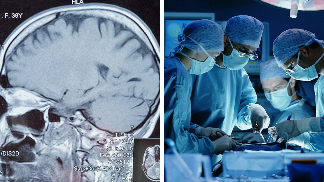 Bărbat cu cancer cerebral suspect, găsit cu ceva mult mai înfiorător