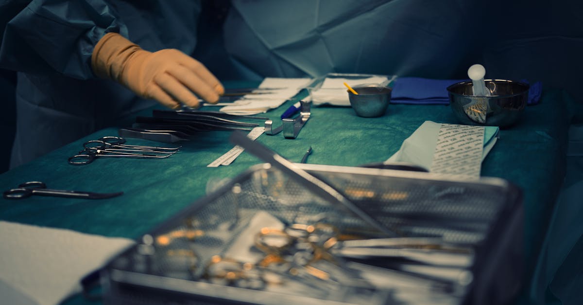 Calcul de 1,3 kg scos din vezică - recordul din Guangdong care a șocat chirurgii