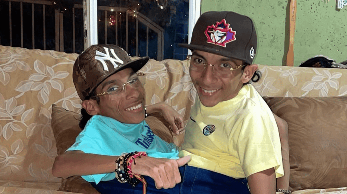 Gemenii siamezi din Ecuador, influenceri pe Instagram, au murit la 27 de ani