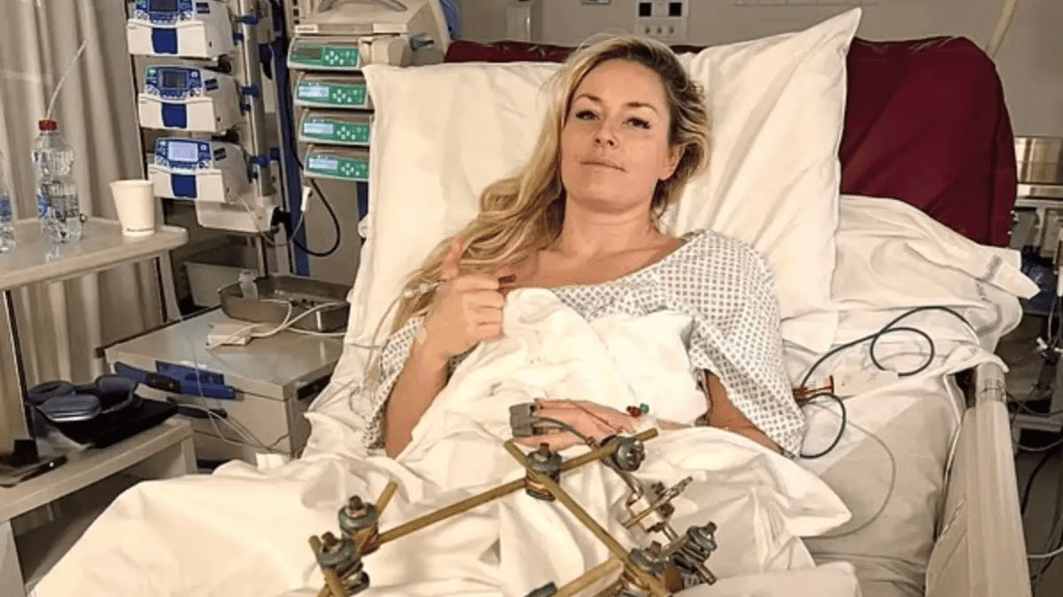 Lindsey Vonn promite revenirea după ce doctorii se temeau de amputare